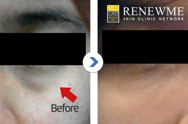 Renewme Skin Clinic Seocho
