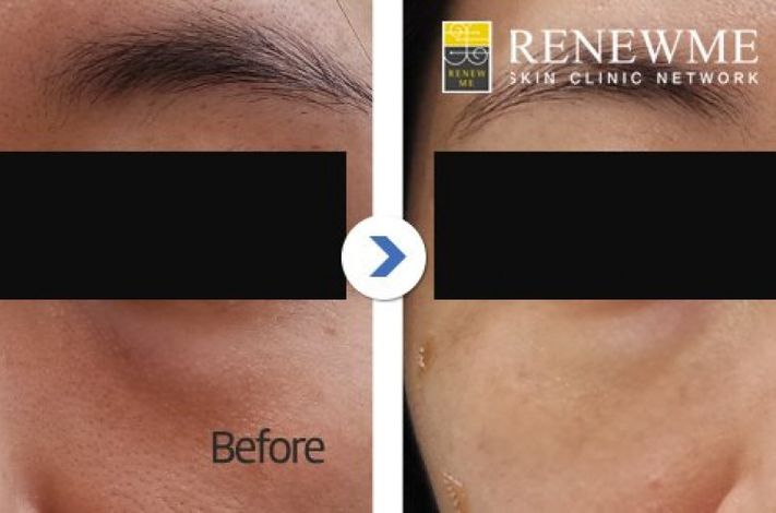 Renewme Skin Clinic Hwagok