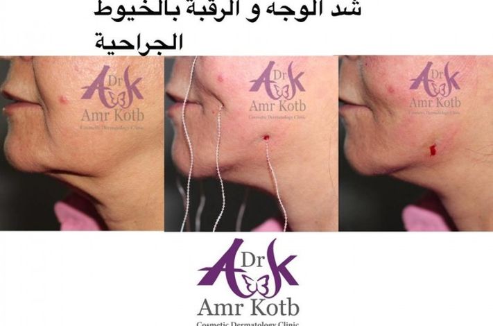 Dr Amr Kotb Dermatology Clinic