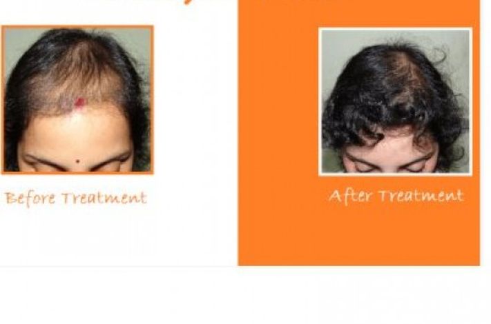 Orange tree aesthetic and hair restoration centre