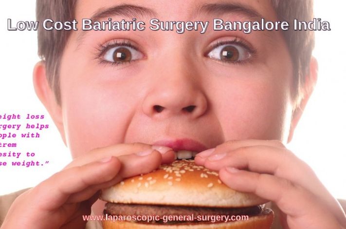 General and Laparoscopic Surgery India