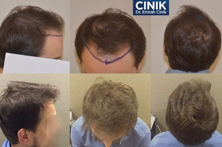 Dr. Cinik Hair Transplant Clinic