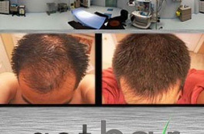 Get Hair -  Hair Transplant Professionals