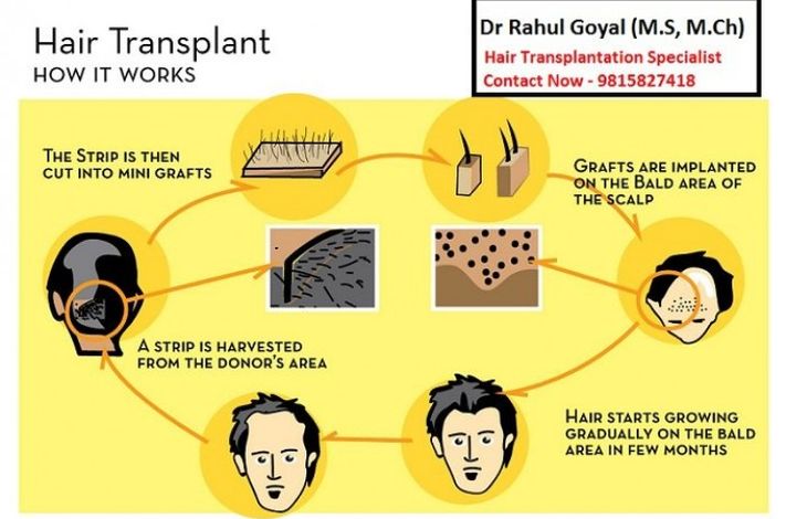 Chandigarh Cosmetic  and  Hair Transplantation Surgeon