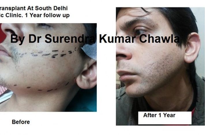 South Delhi Cosmetic Clinic