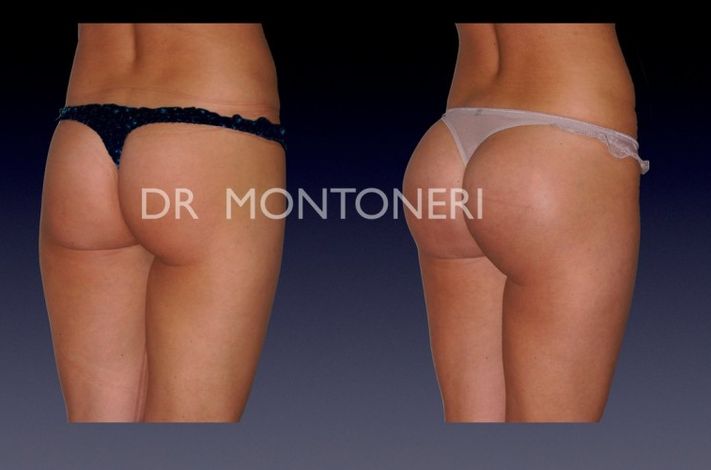 Dr Sebastiano Montoneri-Cosmetic and Plastic Surgery