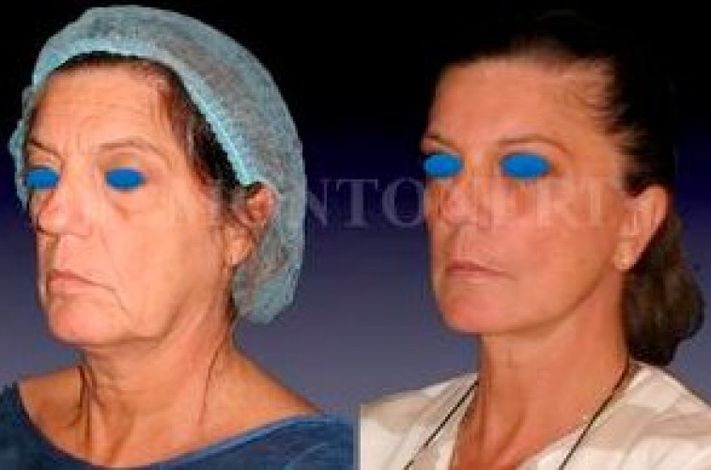 Dr Sebastiano Montoneri-Cosmetic and Plastic Surgery