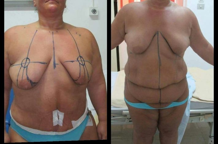 Obesity and Plastic Surgery Clinic