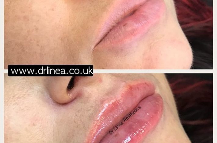 Dr Linea Aesthetics - London