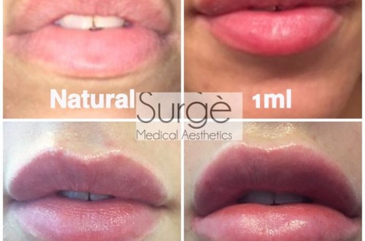 Surge Medical Aesthetics