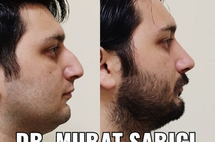 Assoc. Prof. Murat Sarıcı