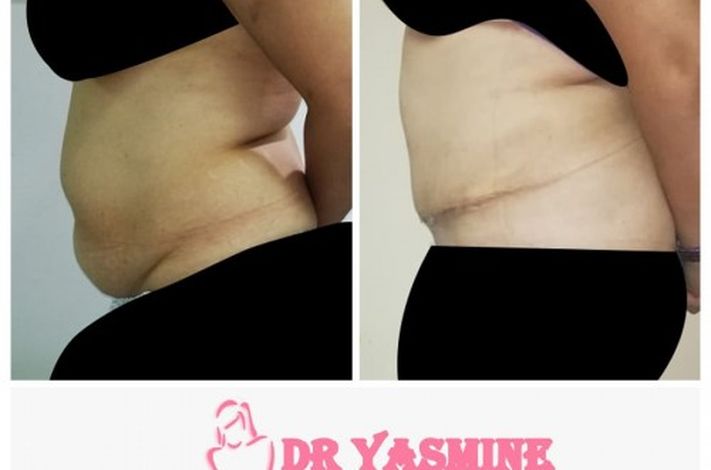 Yasmine Darwish plastic surgery clinic