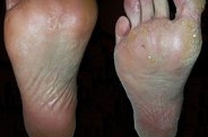 The Harley Medical Foot and Nail Laser Clinic: Marion Yau