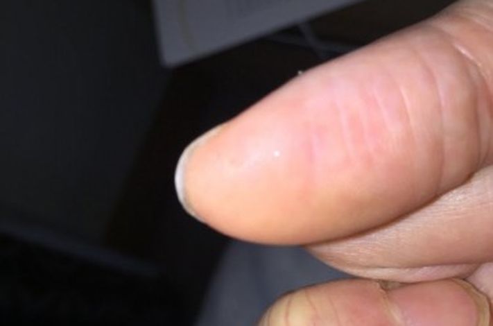 The Harley Medical Foot and Nail Laser Clinic: Marion Yau