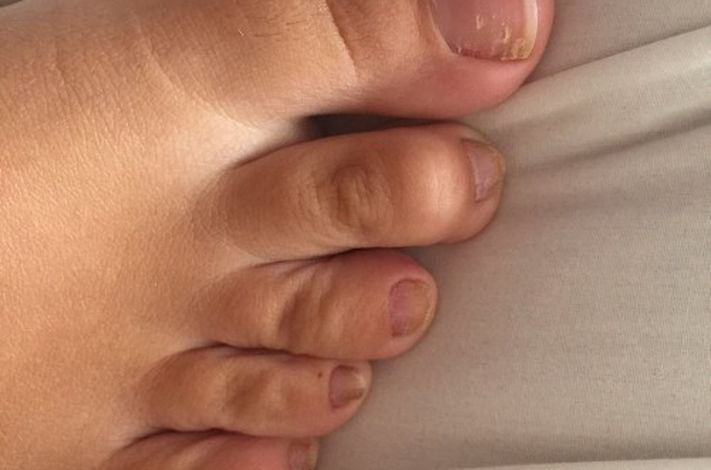 The Harley Medical Foot and Nail Laser Clinic: Marion Yau