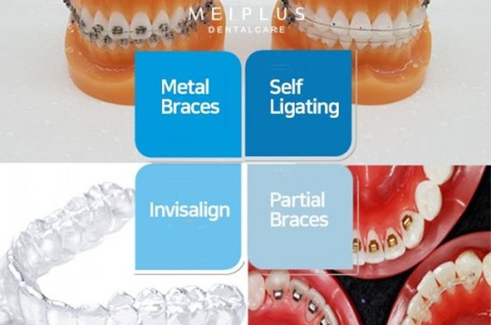 Meiplus Dentalcare-Telok Ayer Branch