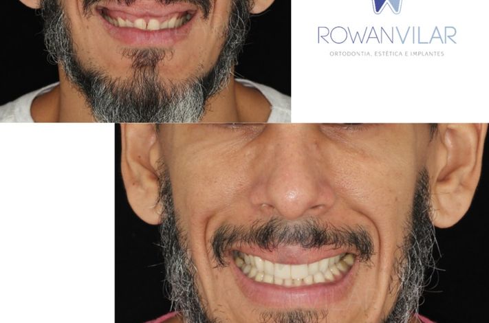 Dr Rowan Vilar - Best cosmetic dentist in Rio de Janeiro - Brazil