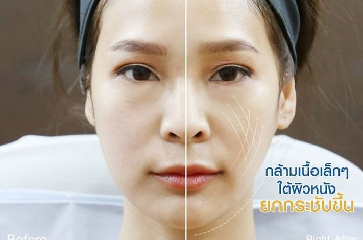 SLC Siam Laser Clinic, Pathum Thani