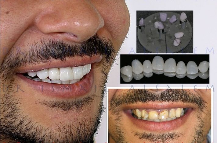 Alsalem Dental Clinics