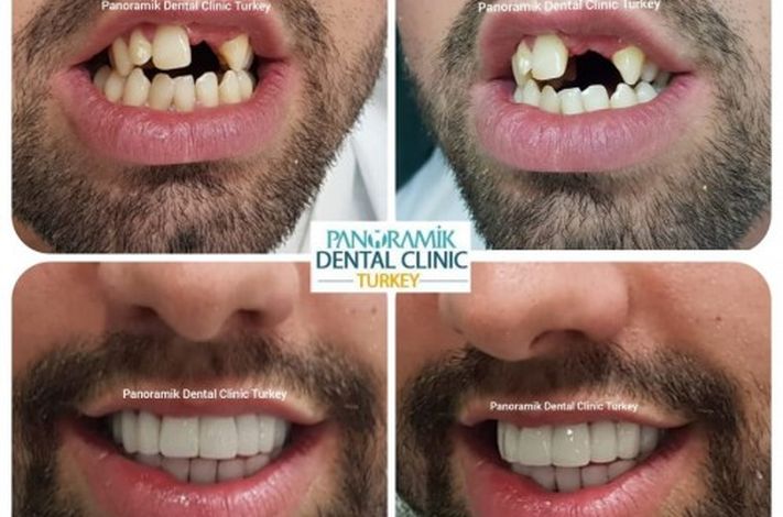 Private Panoramik Oral and Dental Clinic