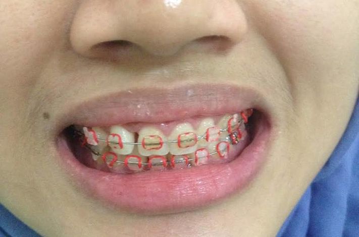 EXO Dental Care