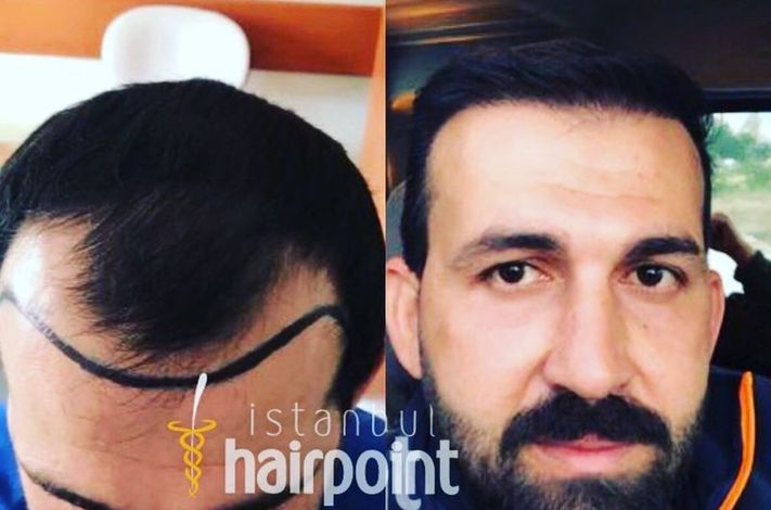 ISTANBUL HAIRPOINT 