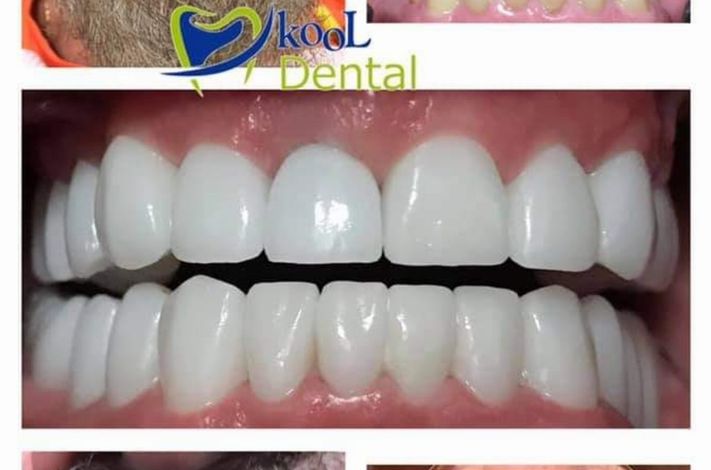 Kool Dental