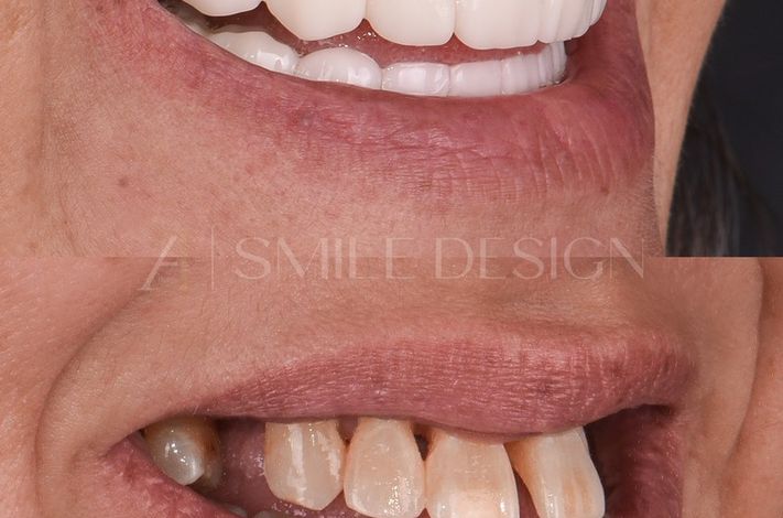A1 Smile Design