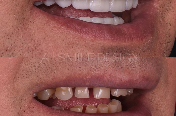 A1 Smile Design