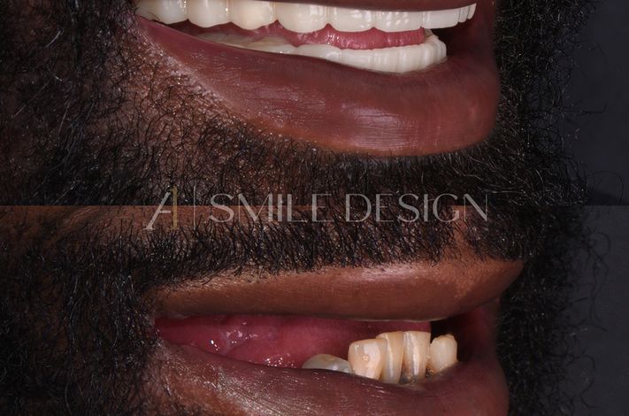 A1 Smile Design