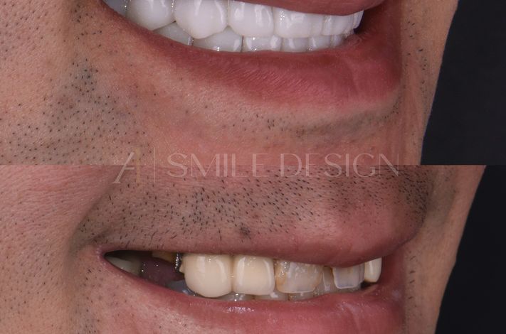 A1 Smile Design