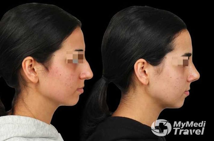 The Nose Aesthetic Clinic - Dr. Cem Altindag