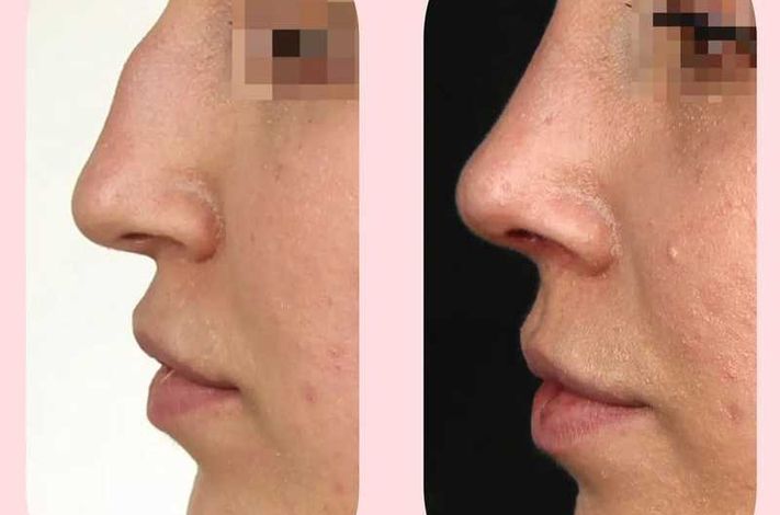 The Nose Aesthetic Clinic - Dr. Cem Altindag