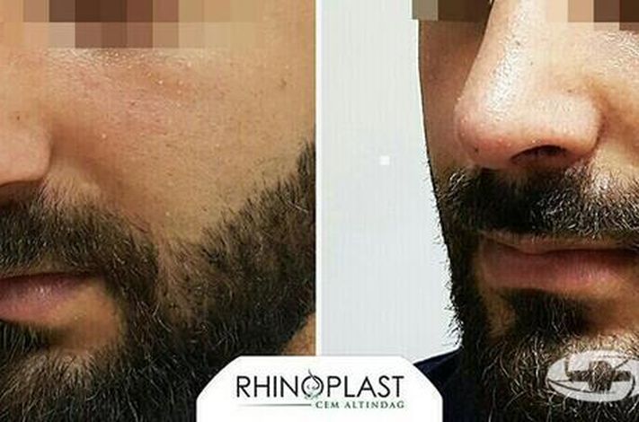 The Nose Aesthetic Clinic - Dr. Cem Altindag