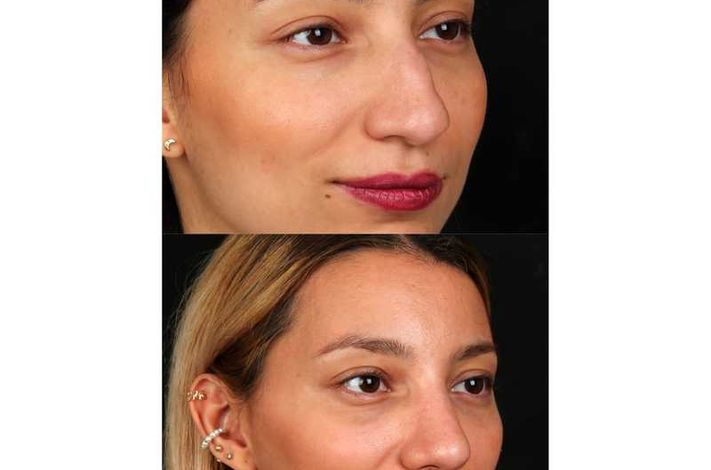 The Nose Aesthetic Clinic - Dr. Cem Altindag