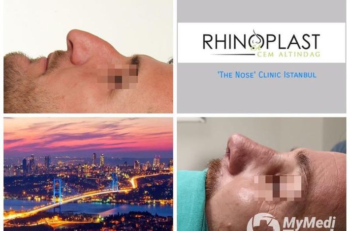 The Nose Aesthetic Clinic - Dr. Cem Altindag