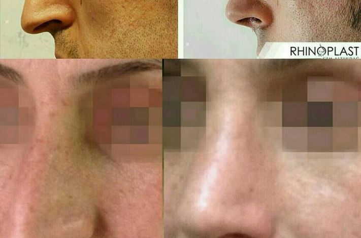 The Nose Aesthetic Clinic - Dr. Cem Altindag