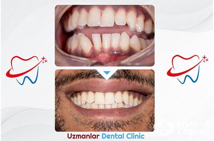 UZMANLAR Dental Clinic