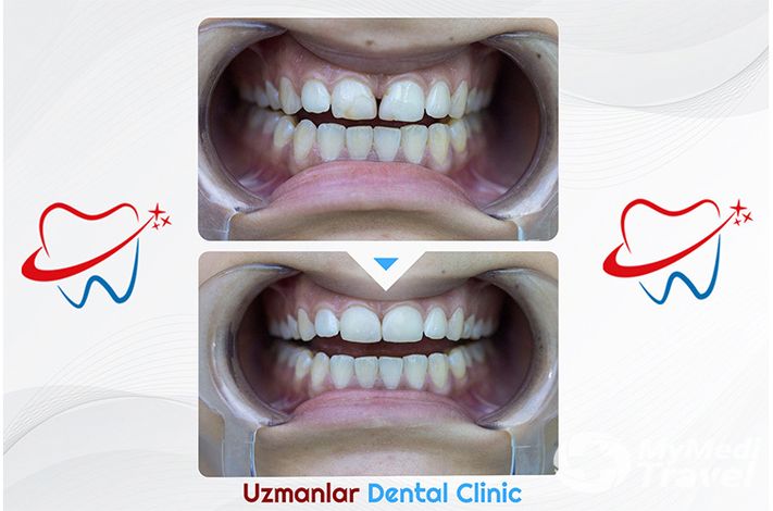 UZMANLAR Dental Clinic
