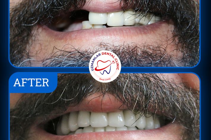 UZMANLAR Dental Clinic