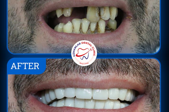 UZMANLAR Dental Clinic