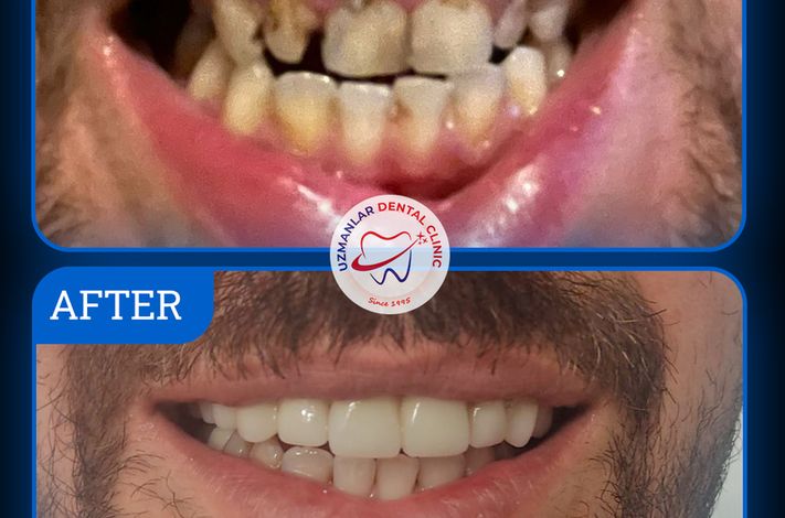 UZMANLAR Dental Clinic