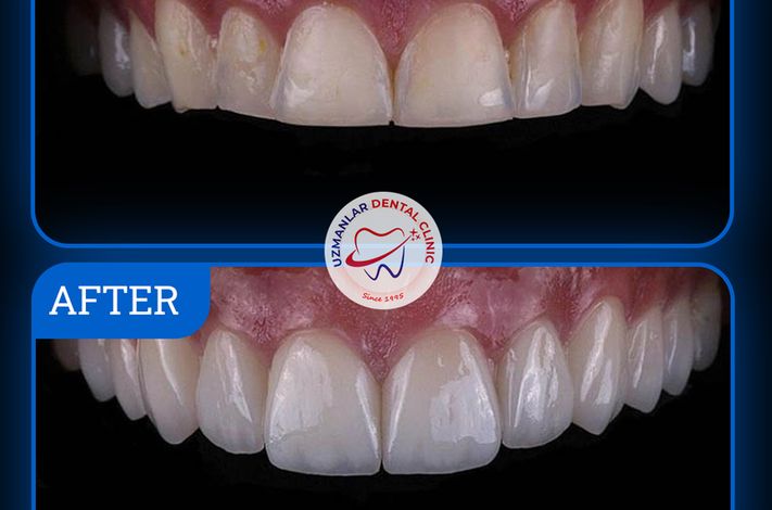 UZMANLAR Dental Clinic