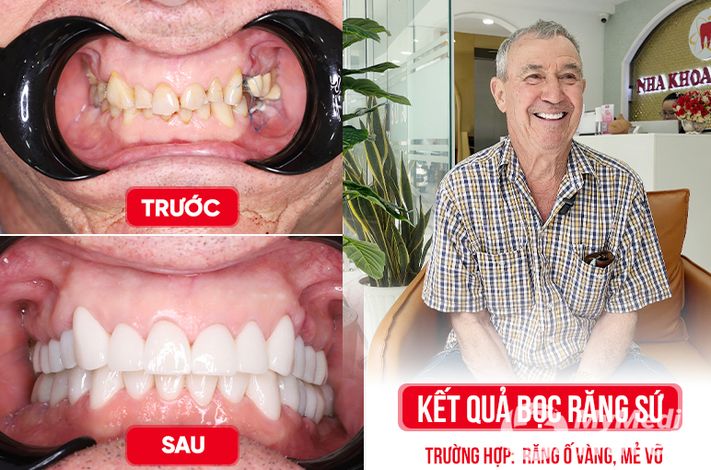 Saigon Center Dental Clinic