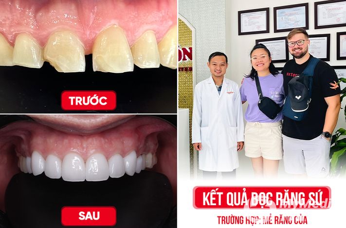 Saigon Center Dental Clinic