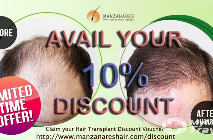 Manzanares Hair Restoration Center