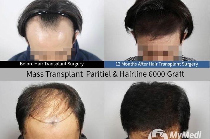 Moaman Hair Transplant Clinic