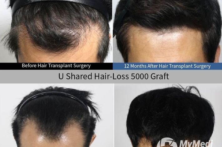 Moaman Hair Transplant Clinic