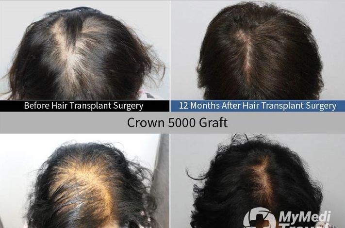 Moaman Hair Transplant Clinic