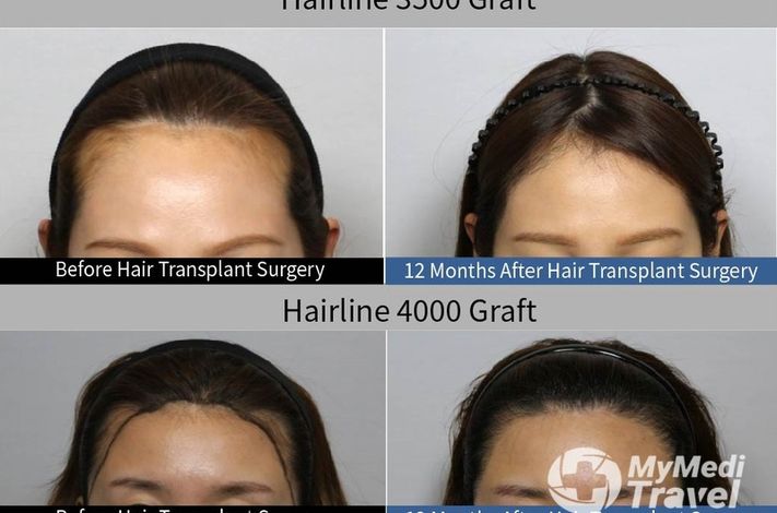 Moaman Hair Transplant Clinic